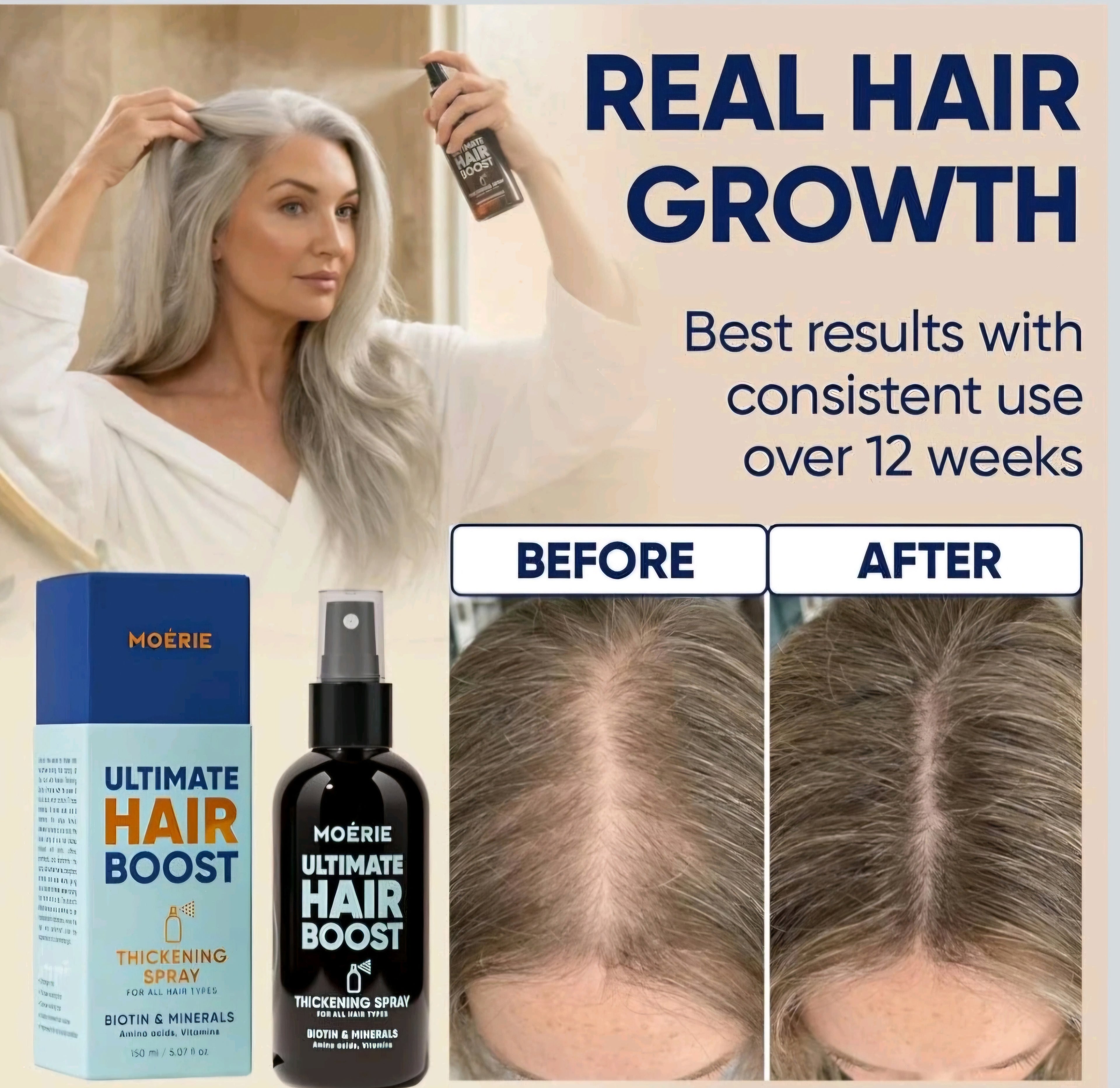 Moerie Hair Growth Serum Spray for Men and Women, Hair Loss Solution - Brand New