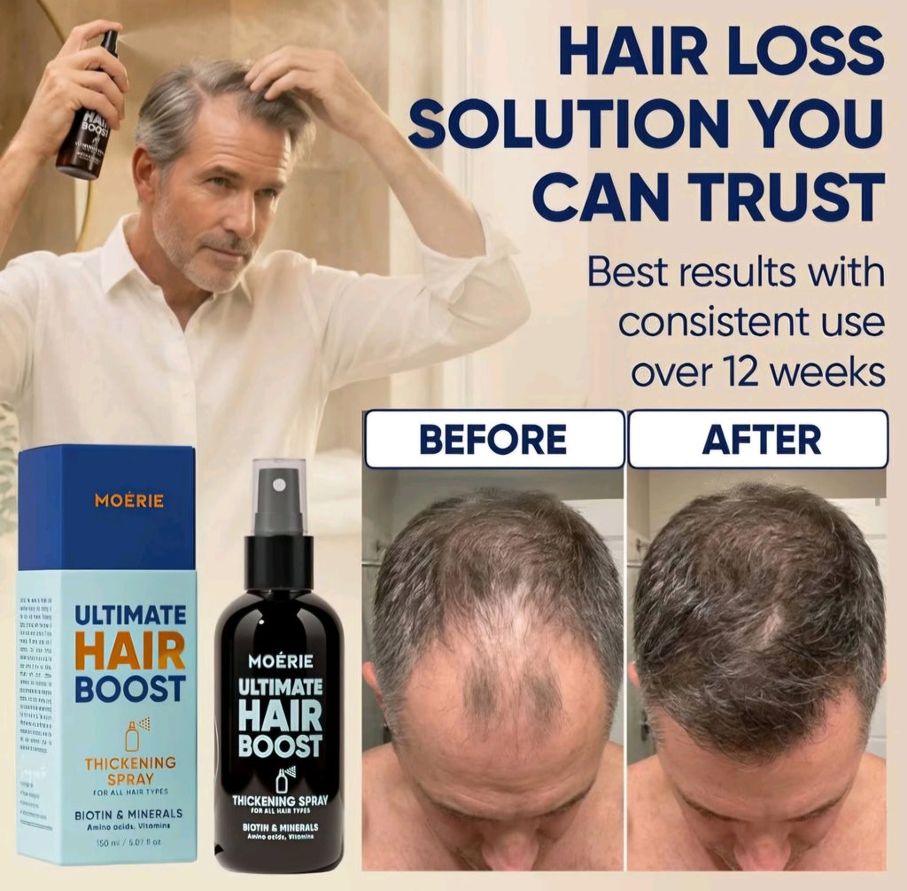 Moerie Hair Growth Serum Spray for Men and Women, Hair Loss Solution - Brand New